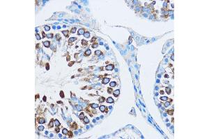 Immunohistochemistry of paraffin-embedded mouse testis using YB-1/YB-1/YBX1 antibody (ABIN6134494, ABIN6150328, ABIN6150330 and ABIN7101815) at dilution of 1:100 (40x lens). (YBX1 antibody  (AA 100-200))