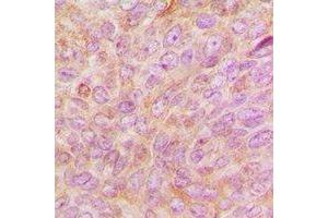 Immunohistochemistry (IHC) image for anti-Proteasome (Prosome, Macropain) 26S Subunit, Non-ATPase, 9 (PSMD9) antibody (ABIN7308242) (PSMD9 antibody)