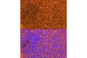 Immunofluorescence analysis of mouse spleen using CD83 Rabbit mAb (ABIN7266223) at dilution of 1:100 (40x lens). (CD83 antibody)