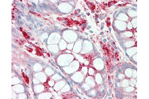 Anti-LAMP1 / CD107a antibody IHC staining of human colon. (LAMP1 antibody)