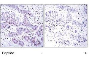 Image no. 1 for anti-Signal Transducer and Activator of Transcription 4 (STAT4) (Tyr693) antibody (ABIN197178) (STAT4 antibody  (Tyr693))