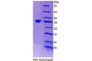 SDS-PAGE analysis of Human SSA1 Protein. (TRIM21 Protein)