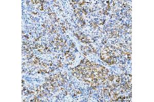 IHC analysis of AGR2 using anti-AGR2 antibody (ABIN5518726). (AGR2 antibody  (AA 21-175))