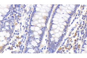 Detection of MT1 in Human Colon Tissue using Polyclonal Antibody to Metallothionein 1 (MT1) (MT1 antibody  (AA 1-61))