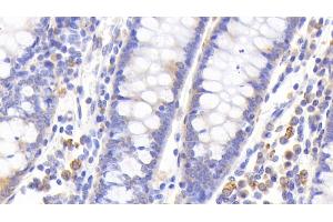 Detection of MT1 in Human Colon Tissue using Polyclonal Antibody to Metallothionein 1 (MT1)