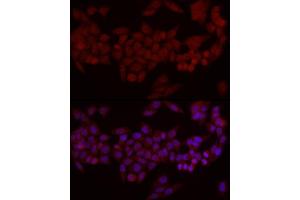 Immunofluorescence analysis of HeLa cells using Smad7 Rabbit pAb (ABIN6133913, ABIN6148093, ABIN6148095 and ABIN6215945) at dilution of 1:50 (40x lens). (SMAD7 antibody  (AA 1-100))