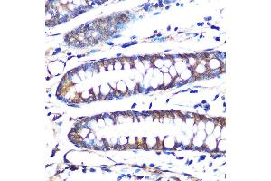 Immunohistochemistry of paraffin-embedded human colon using Aromatase (CYP19) Rabbit mAb (2238) at dilution of 1:100 (40x lens). (Aromatase antibody)