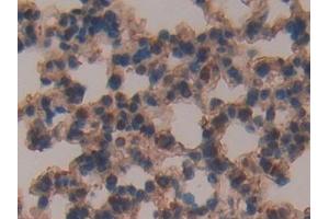 Immunohistochemistry (IHC) image for anti-Complement Factor H (CFH) (AA 915-1156) antibody (ABIN7432277)
