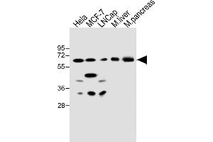All lanes : Anti-CBS Antibody (Center) at 1:500 dilution Lane 1: Hela whole cell lysate Lane 2: MCF-7 whole cell lysate Lane 3: LNCap whole cell lysate Lane 4: mouse liver lysate Lane 5: mouse pancreas lysate Lysates/proteins at 20 μg per lane. (CBS antibody  (AA 301-330))