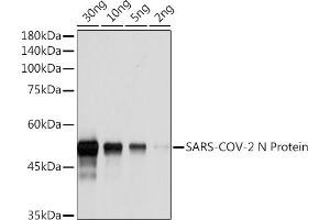 Western blot analysis of SARS-COV-2 N Protein using SARS-COV-2 N Protein Rabbit pAb (ABIN7269049) at 1:1000 dilution. (Nucleoprotein antibody)