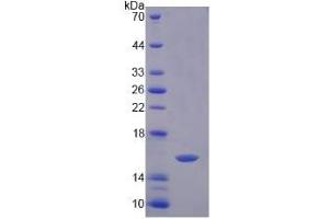 Image no. 1 for Prokineticin 2 (PROK2) (AA 30-118) protein (His tag) (ABIN6236596) (PROK2 Protein (AA 30-118) (His tag))
