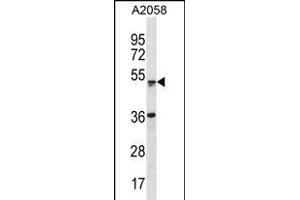 ZSCAN21 Antibody (Center) (ABIN1882042 and ABIN2838688) western blot analysis in  cell line lysates (35 μg/lane).