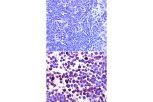 Noxa Immunohistochemistry. (NOXA antibody)