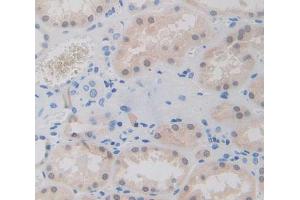 Figure. (GTF2A1 antibody  (AA 2-274))