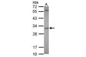 Image no. 1 for anti-Ankyrin Repeat and SOCS Box-Containing 12 (ASB12) (AA 38-303) antibody (ABIN1496738)