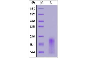 Cynomolgus BAFFR, His Tag on  under reducing (R) condition. (TNFRSF13C Protein (AA 7-76) (His tag))