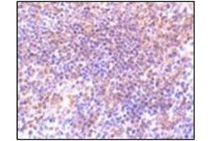 Immunohistochemistry of PAK2 in mouse spleen tissue with this product at 10 μg/ml. (PAK2 antibody  (N-Term))