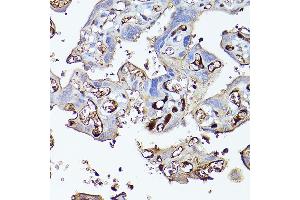 Immunohistochemistry of paraffin-embedded human placenta using Complement factor H Rabbit pAb (ABIN3023096, ABIN3023097, ABIN3023098 and ABIN6219387) at dilution of 1:100 (40x lens). (Complement Factor H antibody  (AA 20-270))