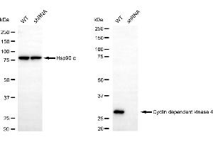 Western blotting analysis using Cyclin dependent kinase 4 antibody (ABIN7798215).
