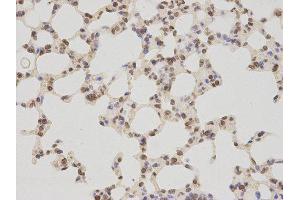 Immunohistochemistry (IHC) image for anti-Thymopoietin (TMPO) antibody (ABIN1875122) (Thymopoietin antibody)