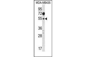 Western blot analysis of MAT1A Antibody (N-term) in MDA-MB435 cell line lysates (35ug/lane). (MAT1A antibody  (N-Term))