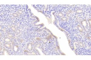 Immunohistochemistry (IHC) image for anti-Serpin Peptidase Inhibitor, Clade G (C1 Inhibitor), Member 1 (SERPING1) (AA 35-179) antibody (ABIN7438466)