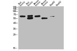 Western blot analysis of 1) Rat Brain Tissue-Low Molecular Protein Marker, 2)Rat Brain Tissue-High Molecular Protein Marker, 3) Mouse Brain Tissue-Low Molecular Protein Marker, 4) Mouse Brain Tissue- High Molecular Protein Marker, 5) HepG2-Low Molecular P (KCNH5 antibody)