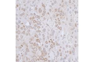 Immunohistochemistry (IHC) image for anti-LAP2 beta/tmpo (AA 225-275) antibody (ABIN7455055) (LAP2 beta/tmpo (AA 225-275) antibody)