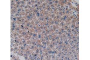 Used in DAB staining on fromalin fixed paraffin- embedded liver tissue (FOS antibody  (AA 6-240))