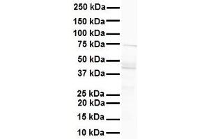 WB Suggested Anti-MCM9 antibody Titration: 1 ug/mL Sample Type: Human liver (MCM9 antibody  (N-Term))