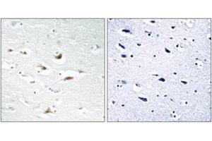 Immunohistochemistry analysis of paraffin-embedded human brain tissue, using Catenin-beta (Ab-33) Antibody. (beta Catenin antibody  (AA 17-66))
