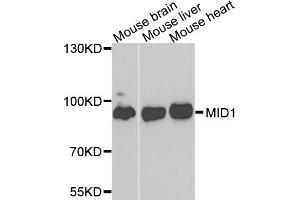 Western blot analysis of extracts of various cell lines, using MID1 antibody (ABIN4904369) at 1:1000 dilution. (MID1 antibody)