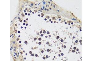 Immunohistochemistry of paraffin-embedded Rat testis using CCDC59 Polyclonal Antibody at dilution of 1:100 (40x lens). (CCDC59 antibody)