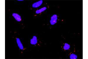 Proximity Ligation Analysis of protein-protein interactions between RICTOR and RPS6KB1. (RICTOR antibody  (AA 1-265))