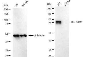 Western blotting analysis using CD44 antibody (ABIN7797973). (Recombinant CD44 antibody)