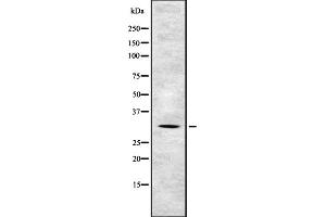 Western blot analysis of TSSC4 expression in HEK293 cells ,The lane on the left is treated with the antigen-specific peptide. (TSSC4 antibody  (C-Term))