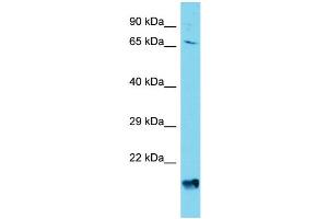 Western Blotting (WB) image for anti-ArfGAP with GTPase Domain, Ankyrin Repeat and PH Domain 4 (AGAP4) (C-Term) antibody (ABIN2791287)