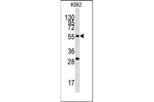 Western blot analysis of anti-CLIC5 Antibody in K562 cell line lysates (35ug/lane). (CLIC5 antibody)