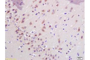 Formalin-fixed and paraffin embedded rat brain labeled with Anti-SHANK3 Polyclonal Antibody, Unconjugated (ABIN1386707) at 1:200 followed by conjugation to the secondary antibody and DAB staining (SHANK3 antibody  (AA 1151-1250))