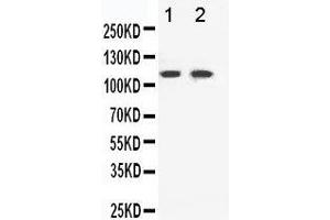 Anti-Eph receptor B3 antibody, Western blotting Lane 1: HELA Cell Lysate Lane 2: A549 Cell Lysate (EPH Receptor B3 antibody  (C-Term))