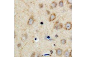 Immunohistochemical analysis of CPI17 staining in human brain formalin fixed paraffin embedded tissue section. (CPI-17 antibody  (N-Term))
