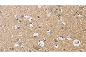 Immunohistochemistry of paraffin-embedded Human brain using ECHS1 Polyclonal Antibody at dilution of 1:35