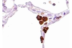 ABIN6267455 at 1/100 staining human bone tissue sections by IHC-P. (SHP1 antibody  (pTyr536))