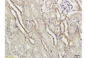 Formalin-fixed and paraffin embedded rat brain tissue labeled with Rabbit Anti-APG5L/ATG5 Polyclonal Antibody (ABIN752413) at 1:200 followed by conjugation to the secondary antibody and DAB staining.