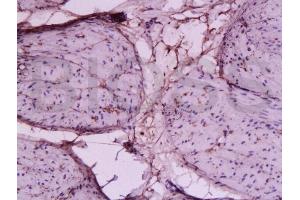 Formalin-fixed and paraffin-embedded dog bladder tissue labeled with Anti-Collagen I Polyclonal Antibody, Unconjugated (ABIN670386) 1:200 followed by conjugation to the secondary antibody and DAB staining (Collagen Type I antibody  (AA 1321-1400))