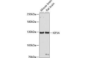 Western blot analysis of extracts of various cell lines, using KIF5A antibody (ABIN1680589, ABIN3017664, ABIN3017665 and ABIN6220202) at 1:1000 dilution.
