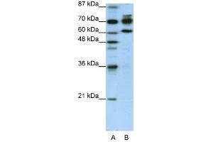 ADARB1 antibody used at 1.