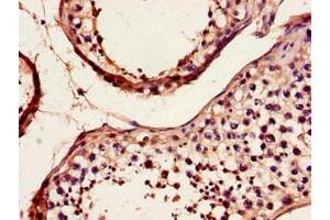 Immunohistochemistry of paraffin-embedded human testis tissue using ABIN7149322 at dilution of 1:100 (DYNC2H1 antibody  (AA 1928-2065))