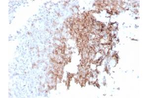 Formalin-fixed, paraffin-embedded human spleen stained with CD21 Recombinant Mouse Monoclonal Antibody (rCR2/1952). (Recombinant CD21 antibody  (AA 44-196))