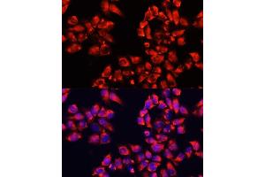 Immunofluorescence analysis of HeLa cells using  antibody (ABIN6133474, ABIN6136782, ABIN6136783 and ABIN6224731) at dilution of 1:100. (ALDH7A1 antibody  (AA 430-539))